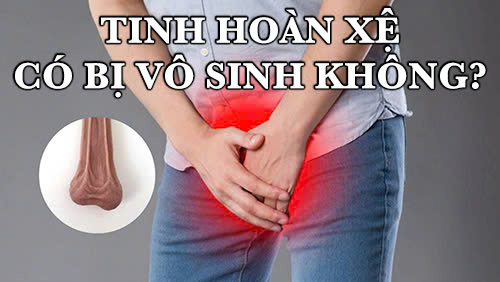 Tìm hiểu Tinh hoàn xệ có bị vô sinh không